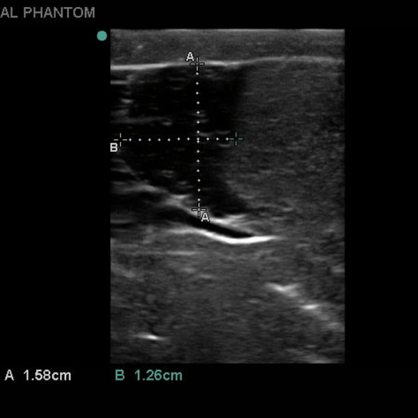Heartsmart Blue Phantom Scrotal Ultrasound Training Model