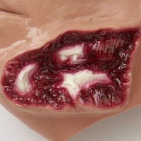 Simulaids Bleeding Jaw Wound