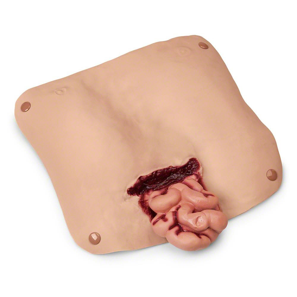 Heartsmart Simulaids Abdominal Wound with Protruding Intestines