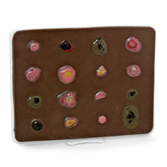 Heartsmart Life/form Skin Cancer Trainer