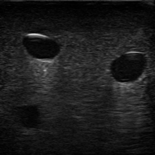Heartsmart Gen II PICC with IV & Arterial Line Vascular Access Ultrasound and X-Ray Trainer