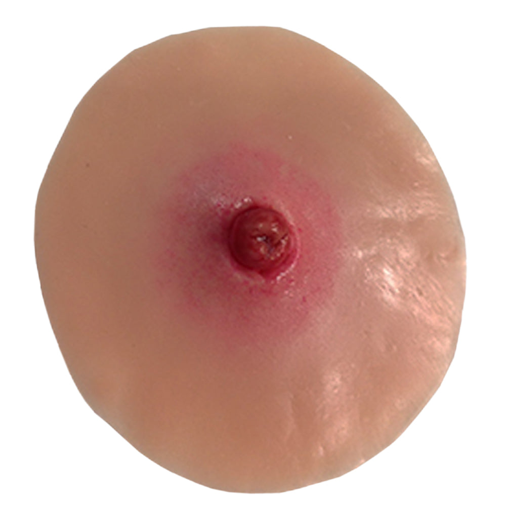Simulaids Adult Stoma