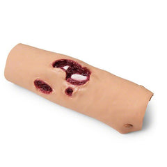 Heartsmart Simulaids Compound Fracture Tibia/Lower Leg