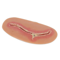 Heartsmart Life/form Moulage Wound - Surgical Site Infection, Level 3 Simulator