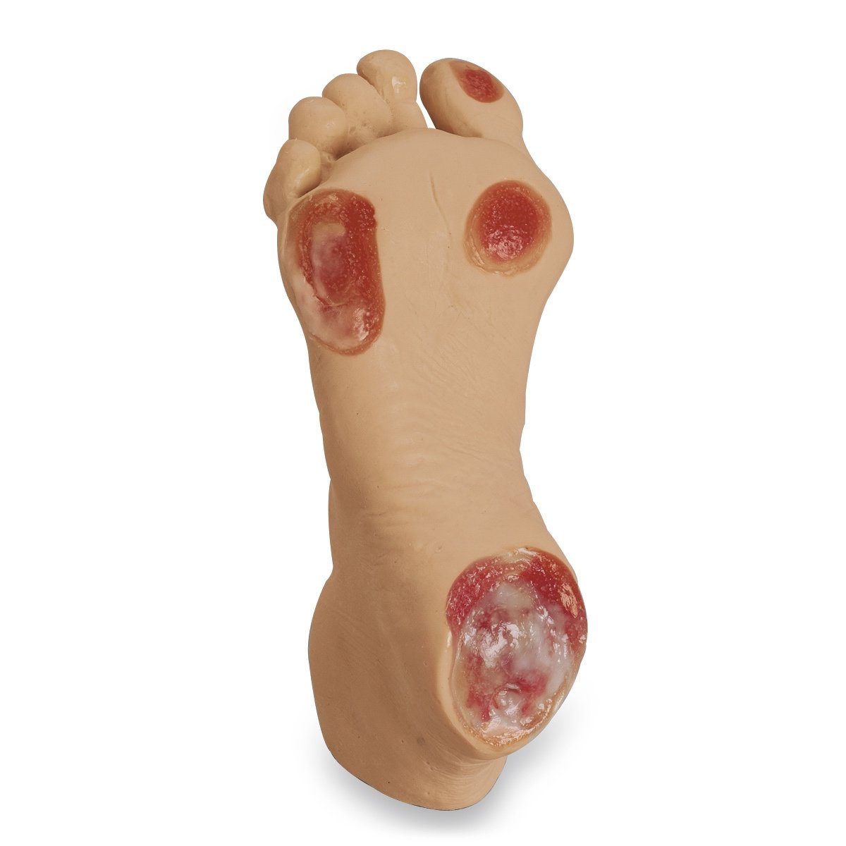 Heartsmart Life/form Elderly Pressure Ulcer Foot