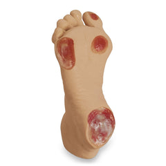 Heartsmart Life/form Elderly Pressure Ulcer Foot