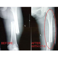FareTec CT-EMS Bilateral Traction Splint
