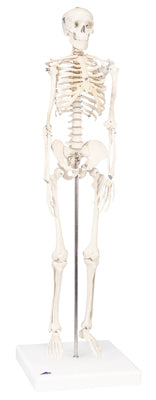 3B Scientific Anatomical Model - Sectional Knee Joint Model, 3 part - Includes 3B Smart Anatomy — for Anatomical Models in Clinical and Institutional Care