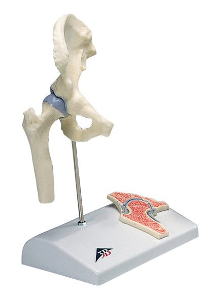 3B Scientific Anatomical Model - mini hip joint with cross section of bone on base - Includes 3B Smart Anatomy — for Anatomical Models in Clinical and Institutional Care