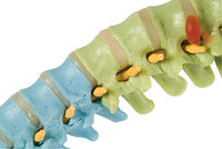 3B Scientific Anatomical Model - flexible spine, didactic - Includes 3B Smart Anatomy — for Anatomical Models in Clinical and Institutional Care