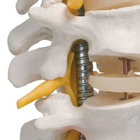 3B Scientific Anatomical Model - highly flexible flexible spine without stand - Includes 3B Smart Anatomy — for Anatomical Models in Clinical and Institutional Care