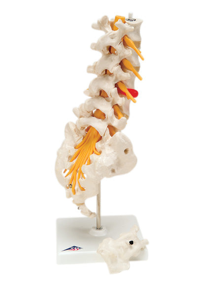 3B Scientific Anatomical Model - lumbar spinal column with dorso-lateral prolapsed disc - Includes 3B Smart Anatomy — for Anatomical Models in Clinical and Institutional Care