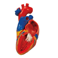 3B Scientific Anatomical Model - heart with bypass, 2-part - Includes 3B Smart Anatomy — for Anatomical Models in Clinical and Institutional Care