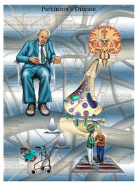 3B Scientific Anatomical Chart - Parkinson's disease, laminated — for Anatomical Charts in Clinical and Institutional Care