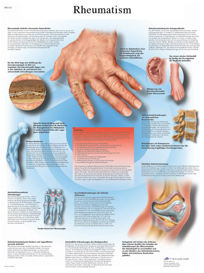 3B Scientific Anatomical Chart - rheumatic diseases, paper — for Exercise and Therapy Floor Work