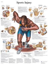 3B Scientific Anatomical Chart - sports injuries, laminated — for Anatomical Charts in Clinical and Institutional Care