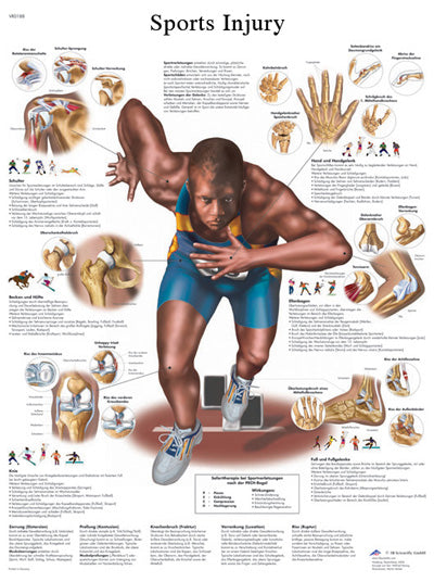 3B Scientific Anatomical Chart - sports injuries, paper — for Anatomical Charts in Clinical and Institutional Care