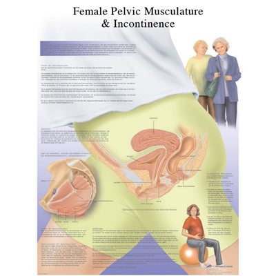 3B Scientific Anatomical Chart - female urinary incontinence chart, laminated — for Anatomical Charts in Clinical and Institutional Care