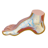 3B Scientific Anatomical Model - Hollow Foot (Pes Cavus) - Includes 3B Smart Anatomy — for Anatomical Models in Clinical and Institutional Care