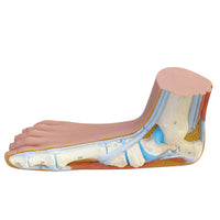 3B Scientific Anatomical Model - Flat Foot (Pes Planus) - Includes 3B Smart Anatomy — for Anatomical Models in Clinical and Institutional Care
