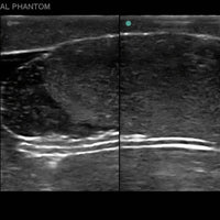 Heartsmart Blue Phantom Scrotal Ultrasound Training Model