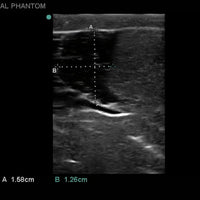 Heartsmart Blue Phantom Scrotal Ultrasound Training Model