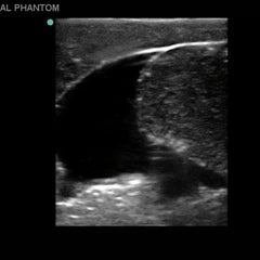 Heartsmart Blue Phantom Scrotal Ultrasound Training Model