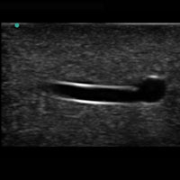 Heartsmart Blue Phantom™ Branched Two Vessel Ultrasound Training Block Model