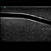 Heartsmart Blue Phantom™ Branched Two Vessel Ultrasound Training Block Model
