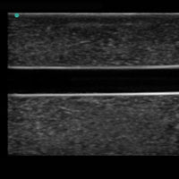 Heartsmart Blue Phantom™ Branched Two Vessel Ultrasound Training Block Model