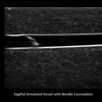 Heartsmart Blue Phantom™ Branched Two Vessel Ultrasound Training Block Model