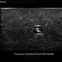 Heartsmart Blue Phantom™ Branched Two Vessel Ultrasound Training Block Model