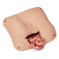 Heartsmart Simulaids Abdominal Wound with Protruding Intestines