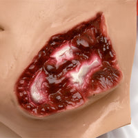 Heartsmart Jaw Wound (Manikin Use Only)