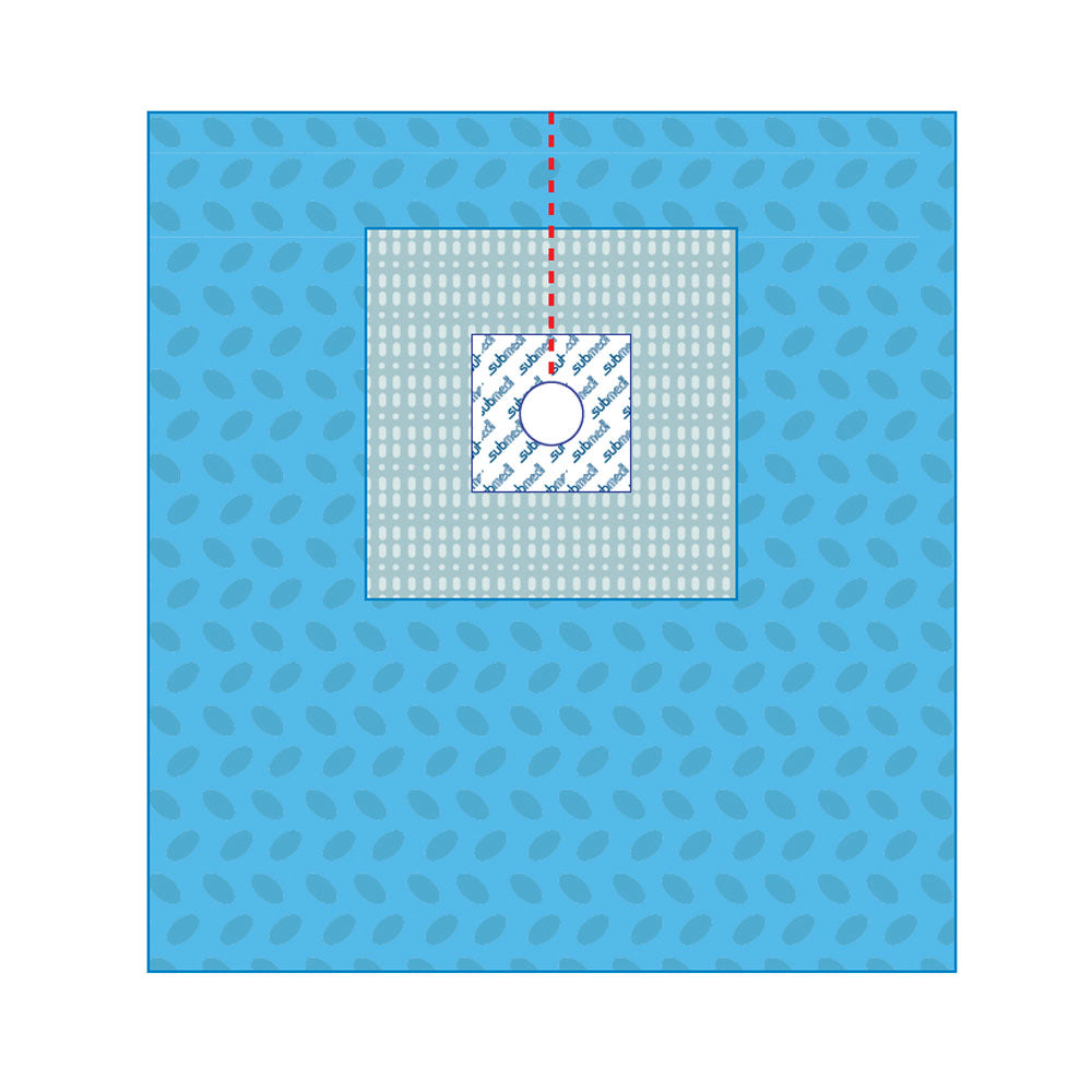 SUBMED CVC (Central Venous Catheter) Drapes with Adhesive Fenestration ...