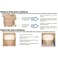 Pediatric Catheter Wrap CathWrap (25 Pack)
