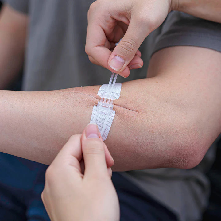 MyMedic ZZIPS Cut Med Pack | Professional Non-Invasive Suture Alternative for Rapid Laceration Repair