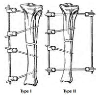 Jorgensen Labs Small Fixation Type II Kit - Professional Veterinary Orthopedic Stabilization System