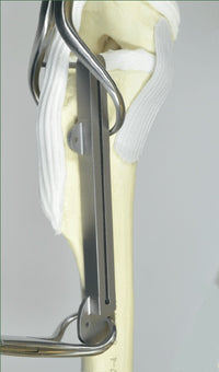 Jorgensen Labs Triple Tibial Osteotomy Kit