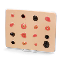 Heartsmart Life/form Skin Cancer Trainer