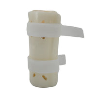 RCAI Pediatric Forearm Fracture Orthosis