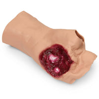 Heartsmart Simulaids Gunshot Wound Palm