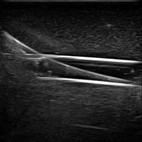 Heartsmart Gen II PICC with IV & Arterial Line Vascular Access Ultrasound and X-Ray Trainer