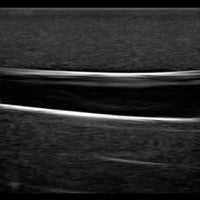 Heartsmart Gen II PICC with IV & Arterial Line Vascular Access Ultrasound and X-Ray Trainer