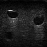 Heartsmart Gen II PICC with IV & Arterial Line Vascular Access Ultrasound and X-Ray Trainer