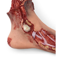 Simulaids Xtreme Trauma Bleeding Leg Moulage for STAT Simulators