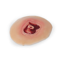 Life/form Moulage Wound - Diabetic Ulcer, 20 mm Simulator