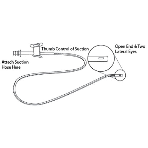 Jorgensen Labs Suction Catheter | Low-Friction Airway Clearance with Control Valve (5-Pack)
