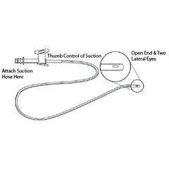 Jorgensen Labs Suction Catheters (Pack of 5)