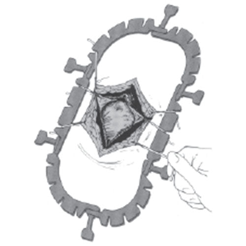 Jorgensen Labs Lone Star Retractor System | Self-Retaining Surgical Site Visualization for Clinical Veterinary Procedures